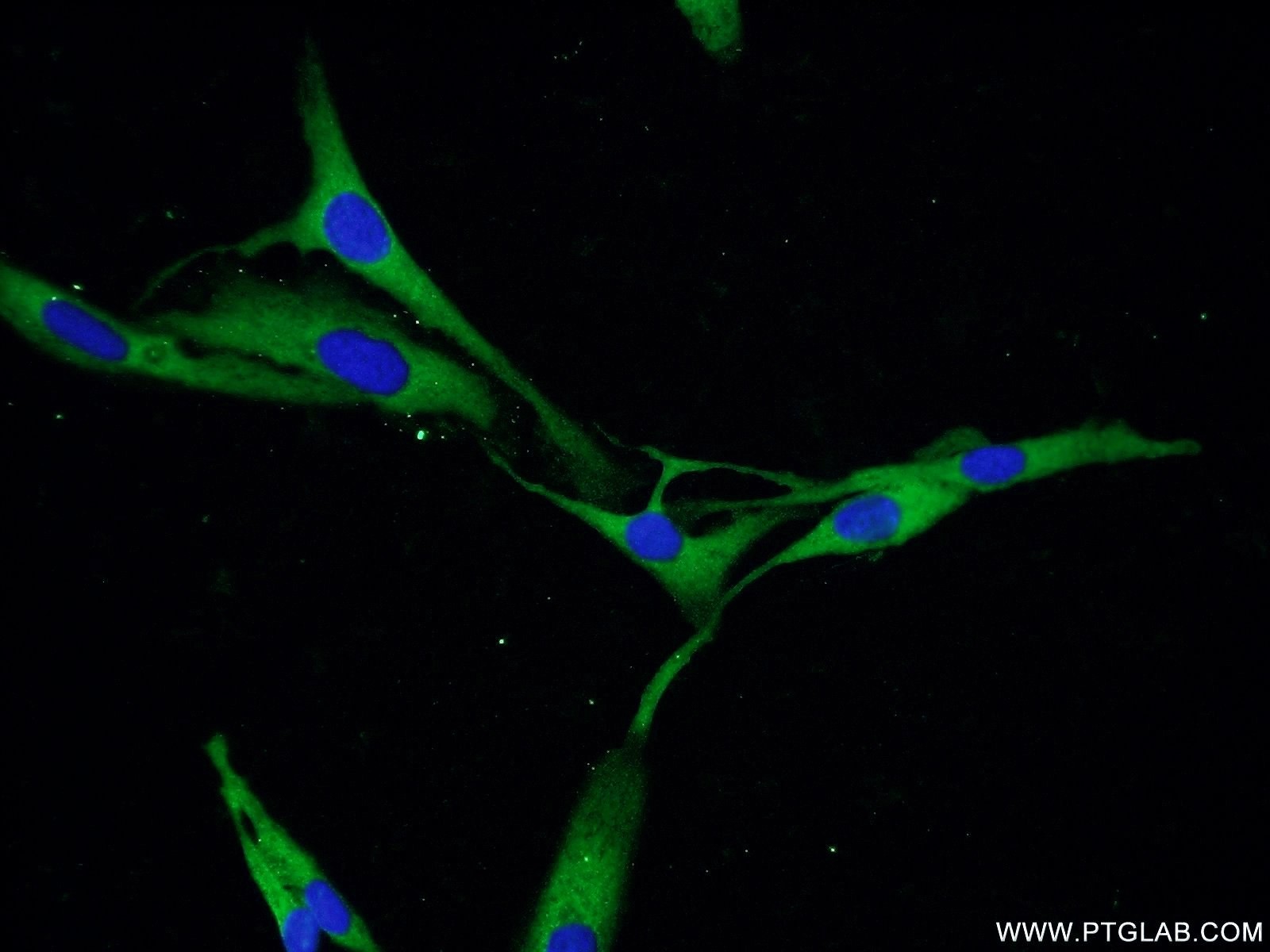 IF Staining of SKOV-3 using 22624-1-AP