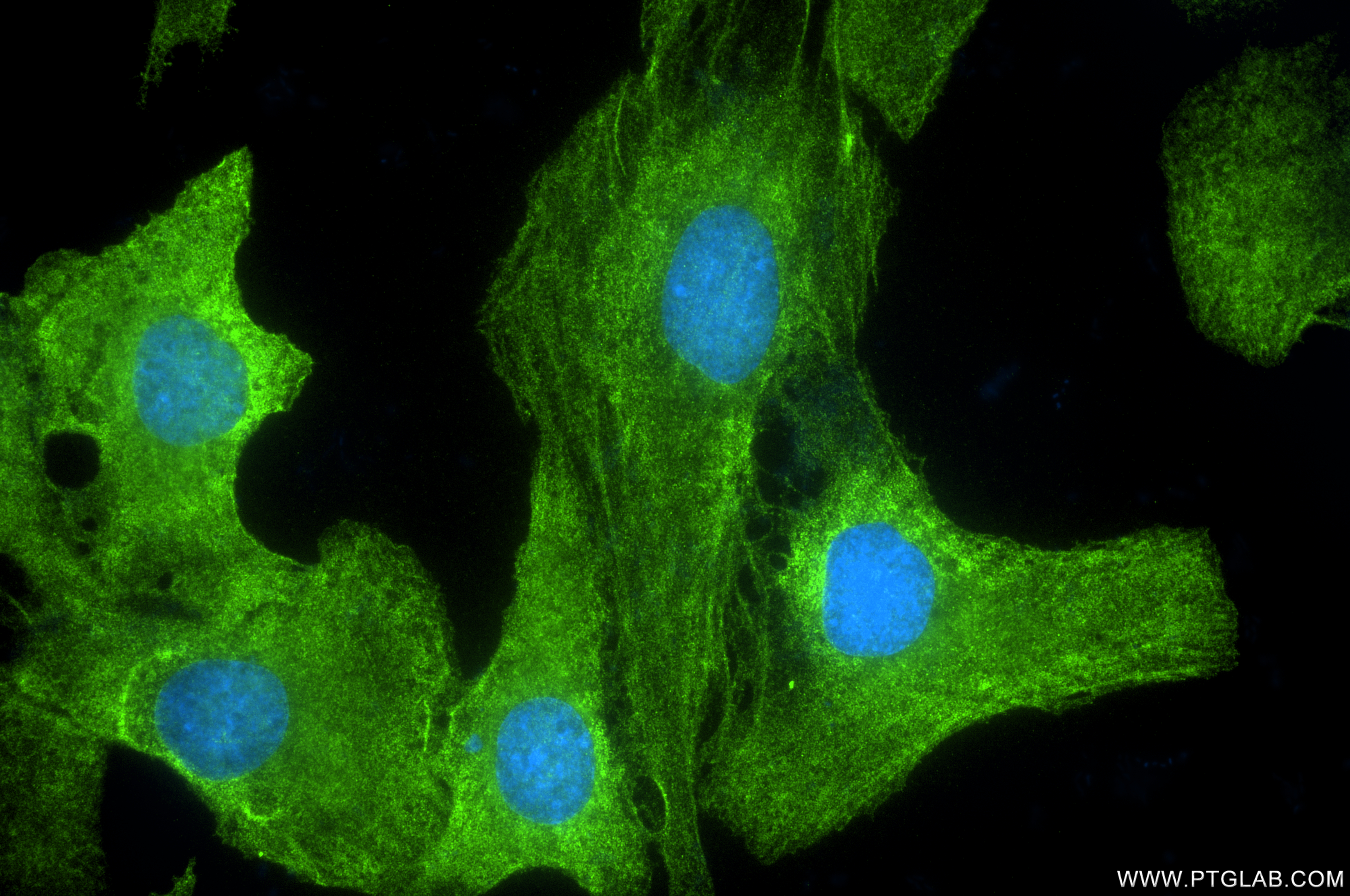 IF Staining of SKOV-3 using 85030-1-RR (same clone as 85030-1-PBS)