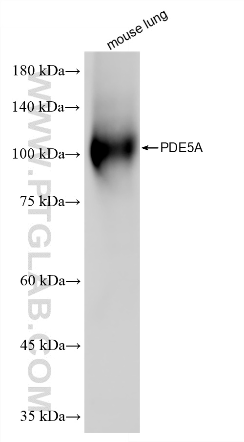 WB analysis of mouse lung using 85030-5-RR