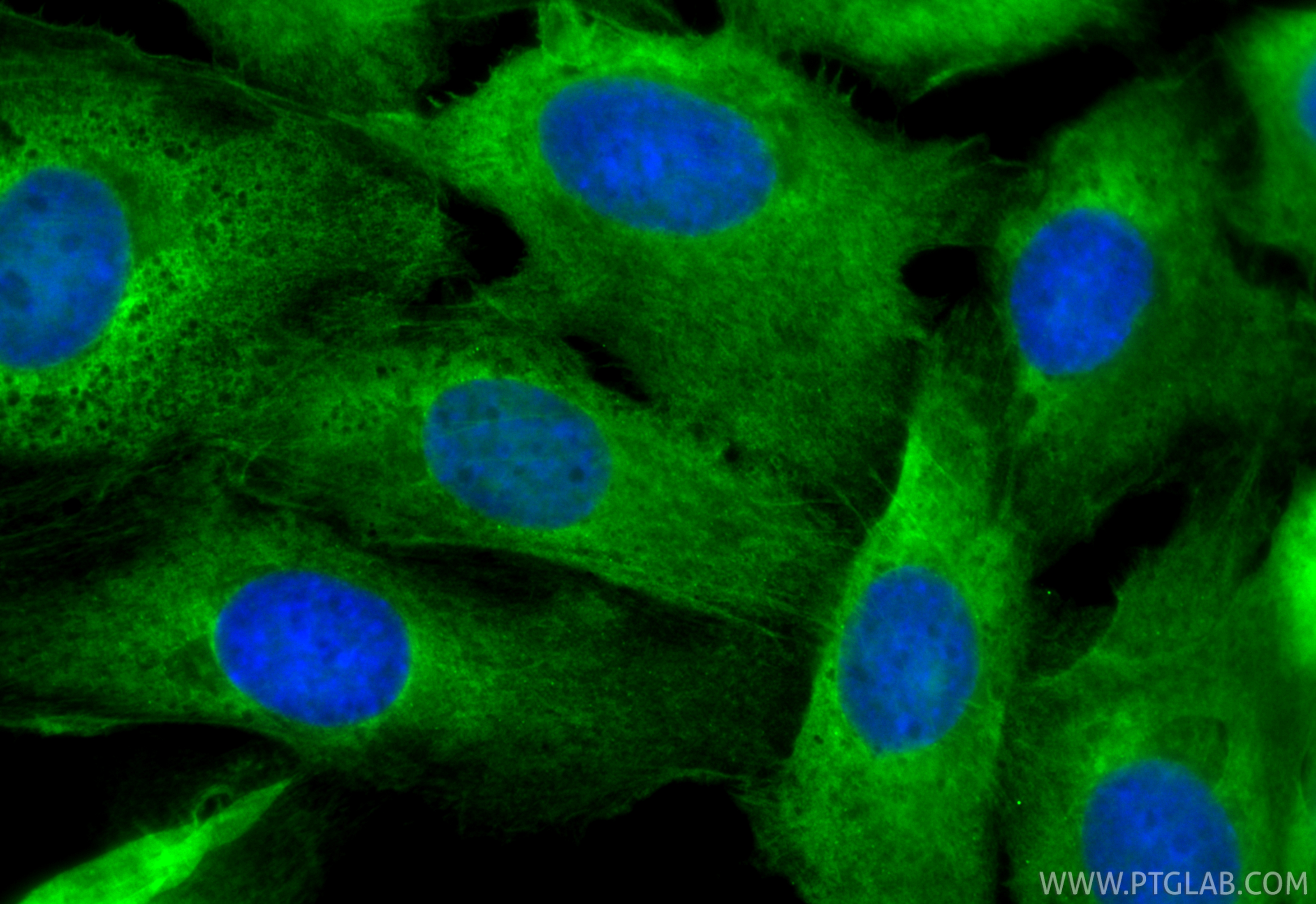 IF Staining of SKOV-3 using CL488-85030