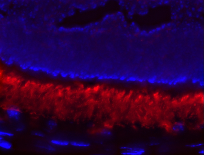 IF Staining of retinal tissue using 21200-1-AP