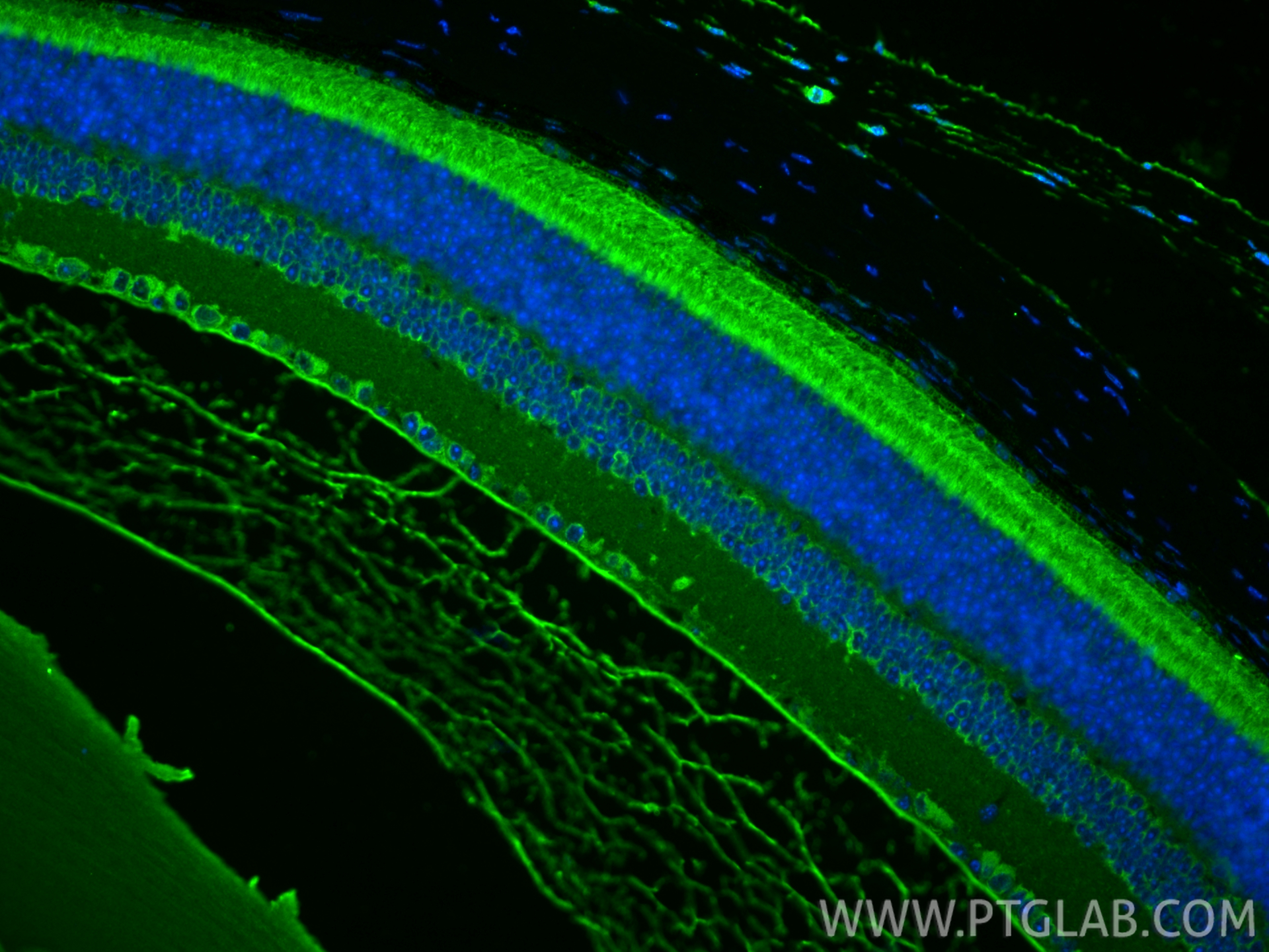 IF Staining of mouse eye using 21200-1-AP