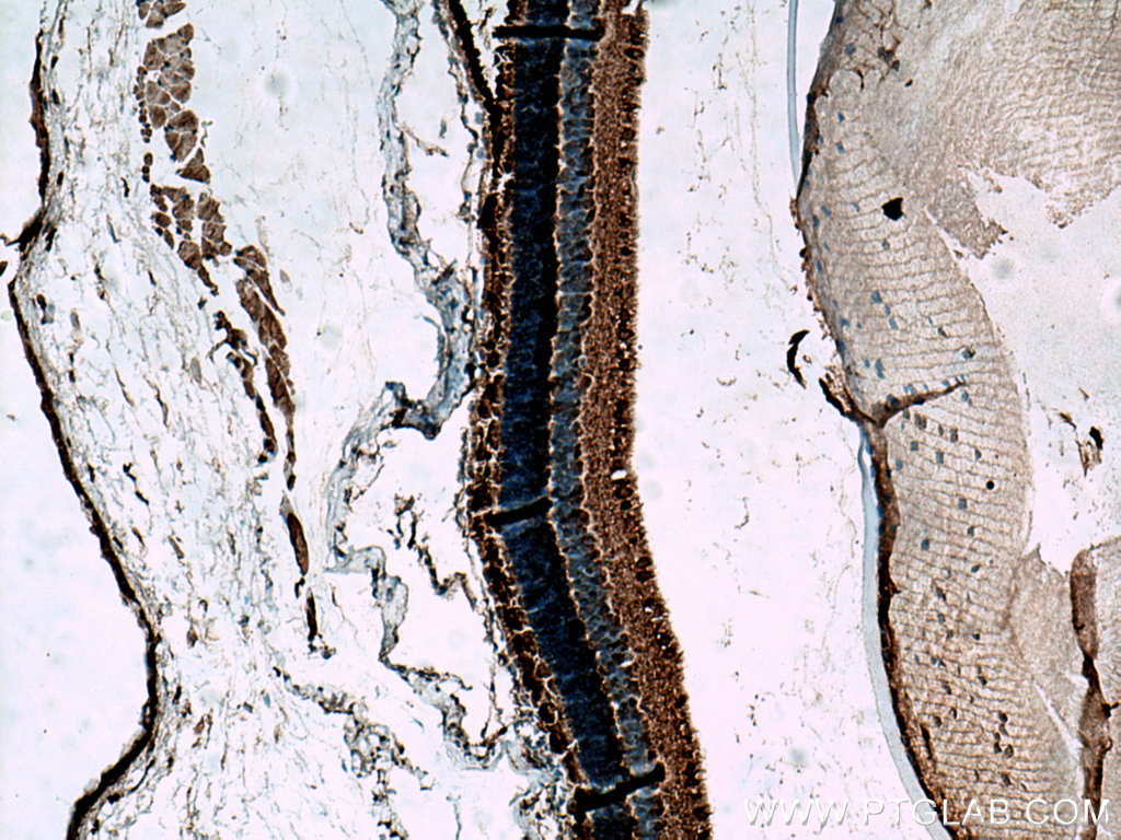 IHC staining of mouse eye using 10353-1-AP
