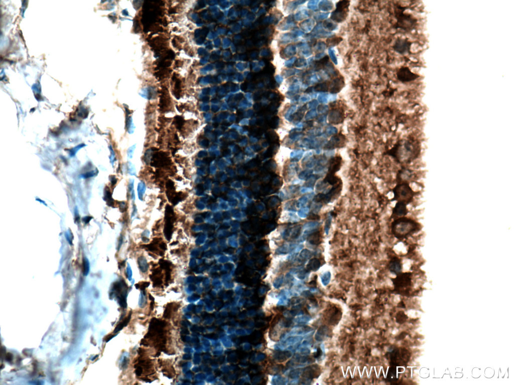 IHC staining of mouse eye using 10353-1-AP