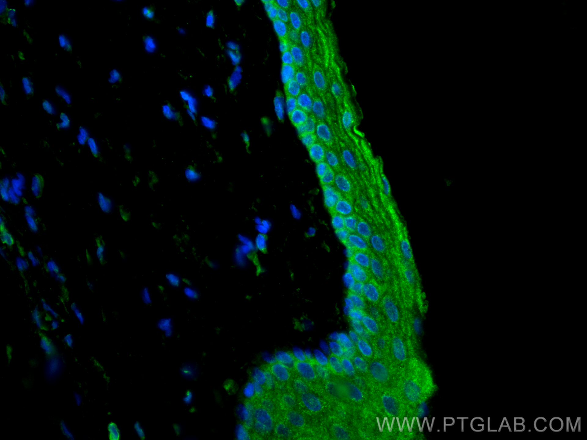 Immunofluorescent analysis of (4% PFA) fixed paraffin-embedded rat eye tissue using PDE6B antibody (22063-1-AP) at dilution of 1:200 and CoraLite®488-Conjugated Goat Anti-Rabbit IgG(H+L) (<a class='green' href='/productredirect?CatalogNo=SA00013-2' target='_blank'>SA00013-2</a>). Heat mediated antigen retrieval with Tris-EDTA buffer (pH 9.0). IF Staining of rat eye using 22063-1-AP