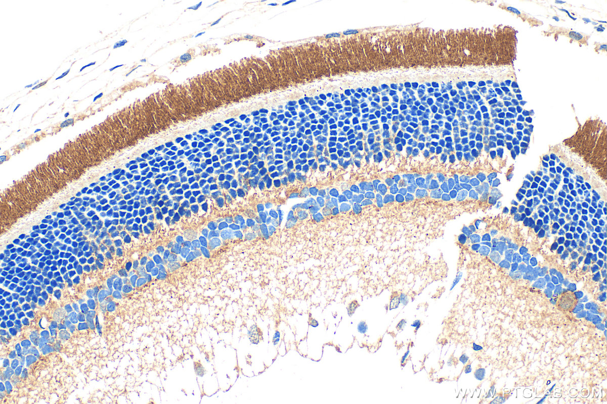 Immunohistochemical analysis of paraffin-embedded rat eye tissue slide using 22063-1-AP (PDE6B antibody) at dilution of 1:600 (under 40x lens). Heat mediated antigen retrieval with Tris-EDTA buffer (pH 9.0). IHC staining of rat eye using 22063-1-AP