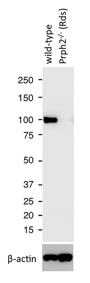 WB analysis of mouse eye tissue using 22063-1-AP