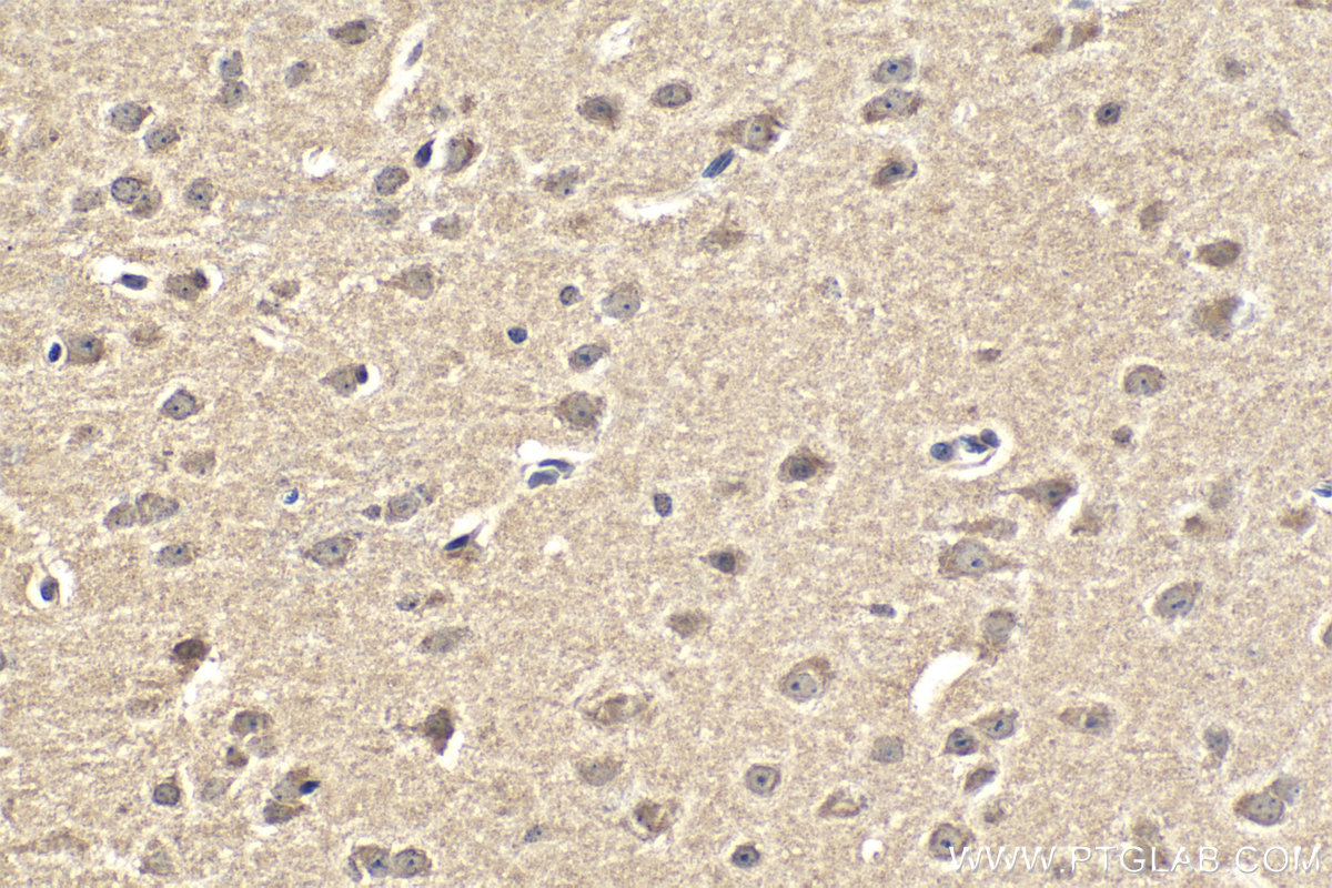 IHC staining of mouse brain using 67565-1-Ig