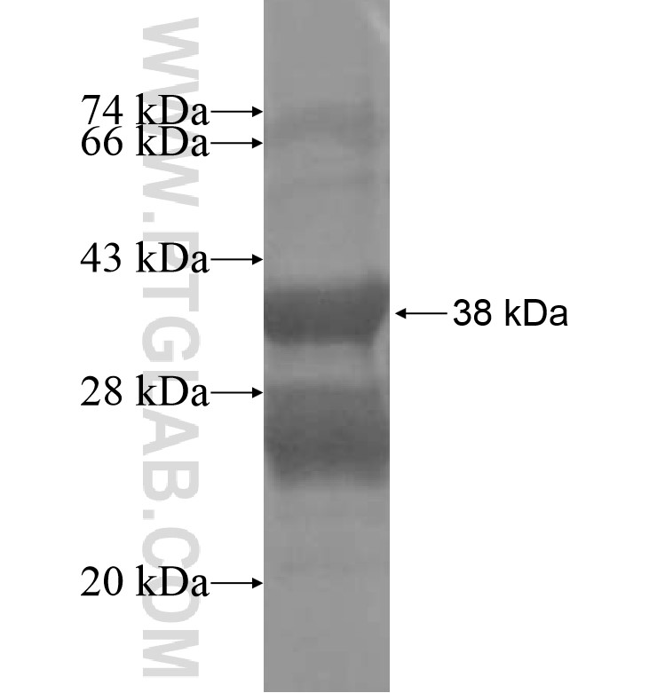 PDE7A fusion protein Ag16253 SDS-PAGE PDE7A fusion protein Ag16253 SDS-PAGE