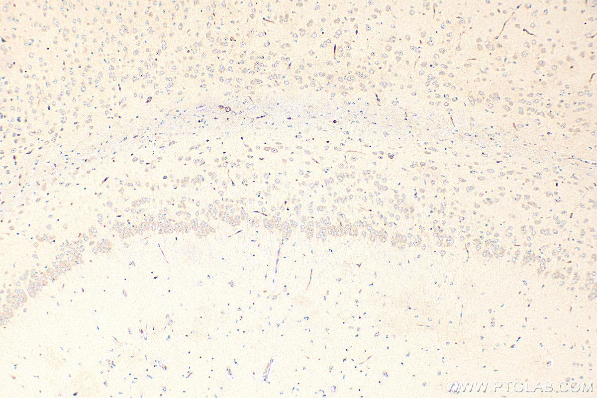 IHC staining of mouse brain using 17771-1-AP