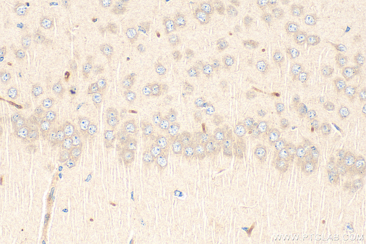 IHC staining of mouse brain using 17771-1-AP