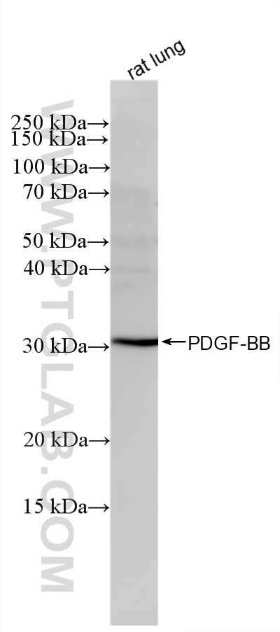 WB analysis of rat lung using 87506-1-RR (same clone as 87506-1-PBS) WB analysis of rat lung using 87506-1-RR (same clone as 87506-1-PBS)