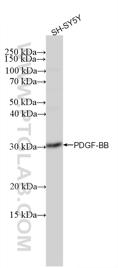 WB analysis of SH-SY5Y using 87506-1-RR (same clone as 87506-1-PBS) WB analysis of SH-SY5Y using 87506-1-RR (same clone as 87506-1-PBS)