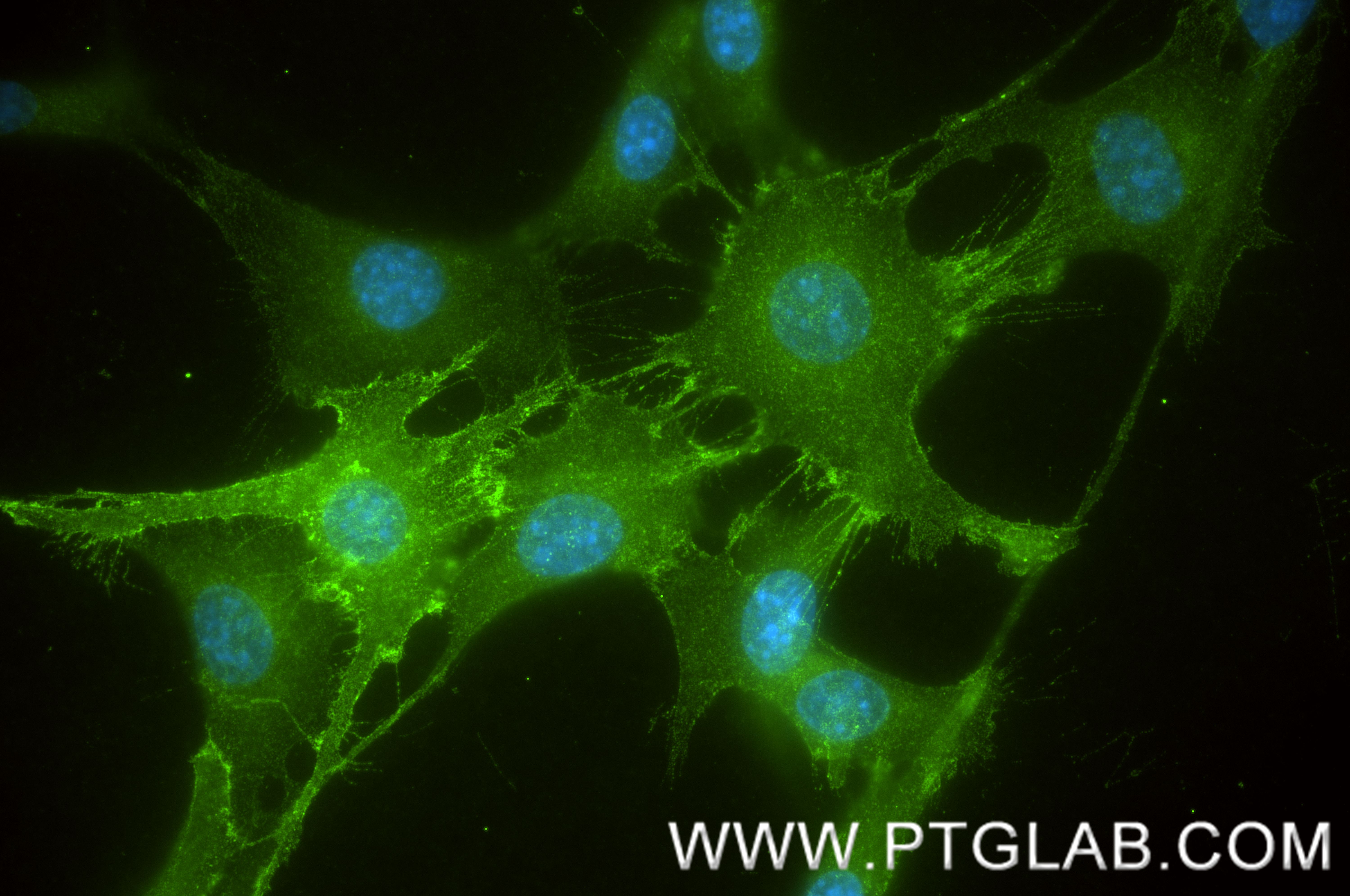 Immunofluorescent analysis of (-20°C Methanol) fixed NIH/3T3 cells using PDGFR beta/CD140b antibody (84388-5-RR, Clone: 241754A6 ) at dilution of 1:400 and CoraLite®488-Conjugated Goat Anti-Rabbit IgG(H+L) (<a class='green' href='/productredirect?CatalogNo=SA00013-2' target='_blank'>SA00013-2</a>). IF Staining of NIH/3T3 using 84388-5-RR