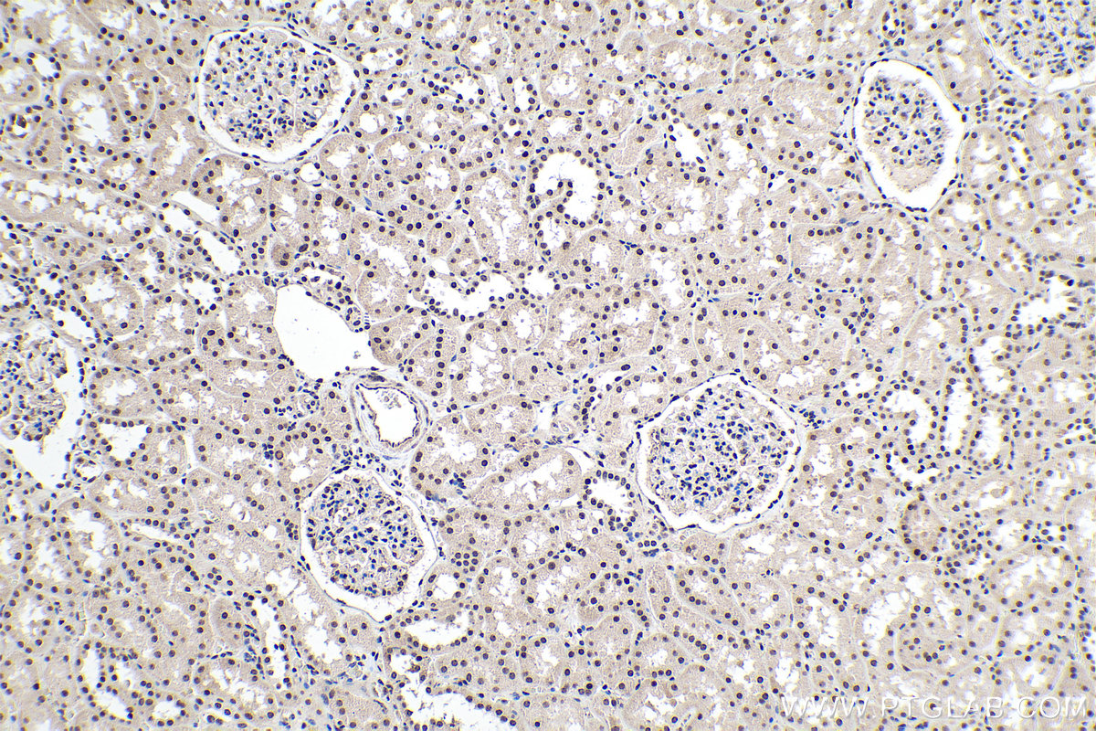 IHC staining of human kidney using 55076-1-AP