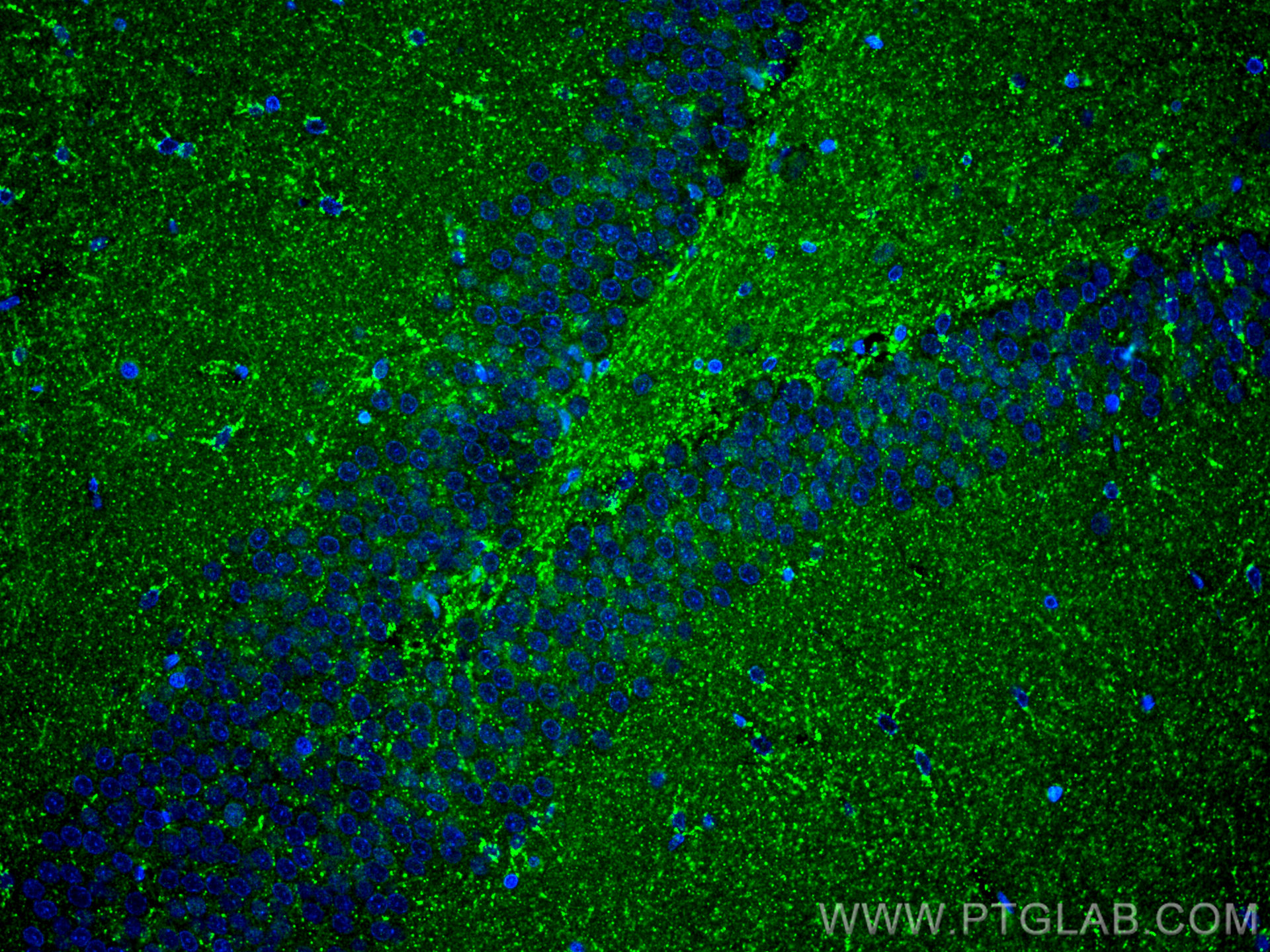 IF Staining of rat brain using 14075-1-AP