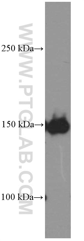 PDGFR alpha Monoclonal antibody