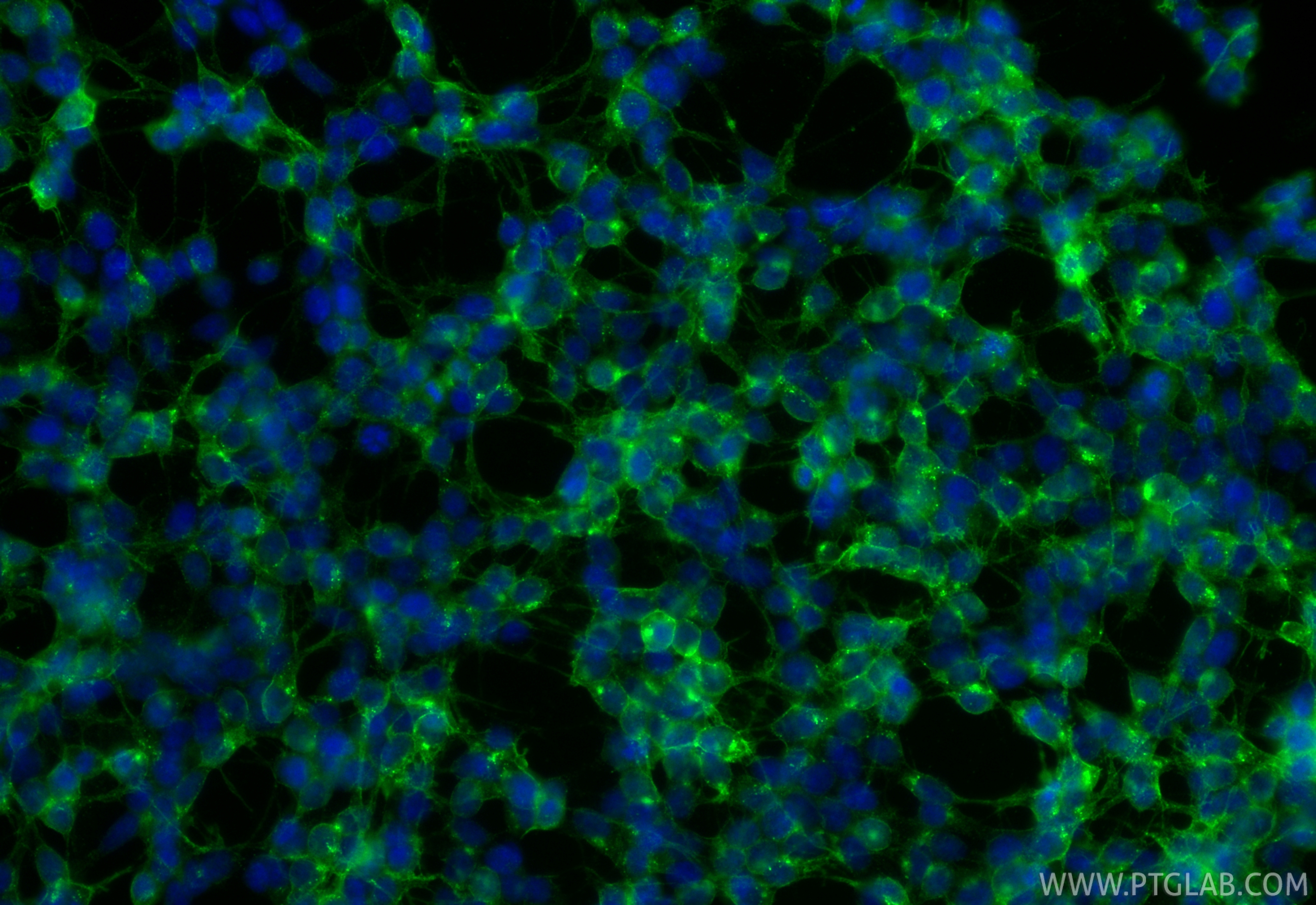 IF Staining of SH-SY5Y using 84383-2-RR IF Staining of SH-SY5Y using 84383-2-RR