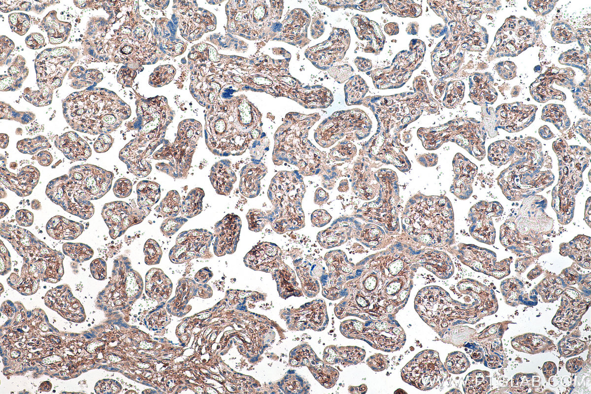 IHC staining of human placenta using 13449-1-AP