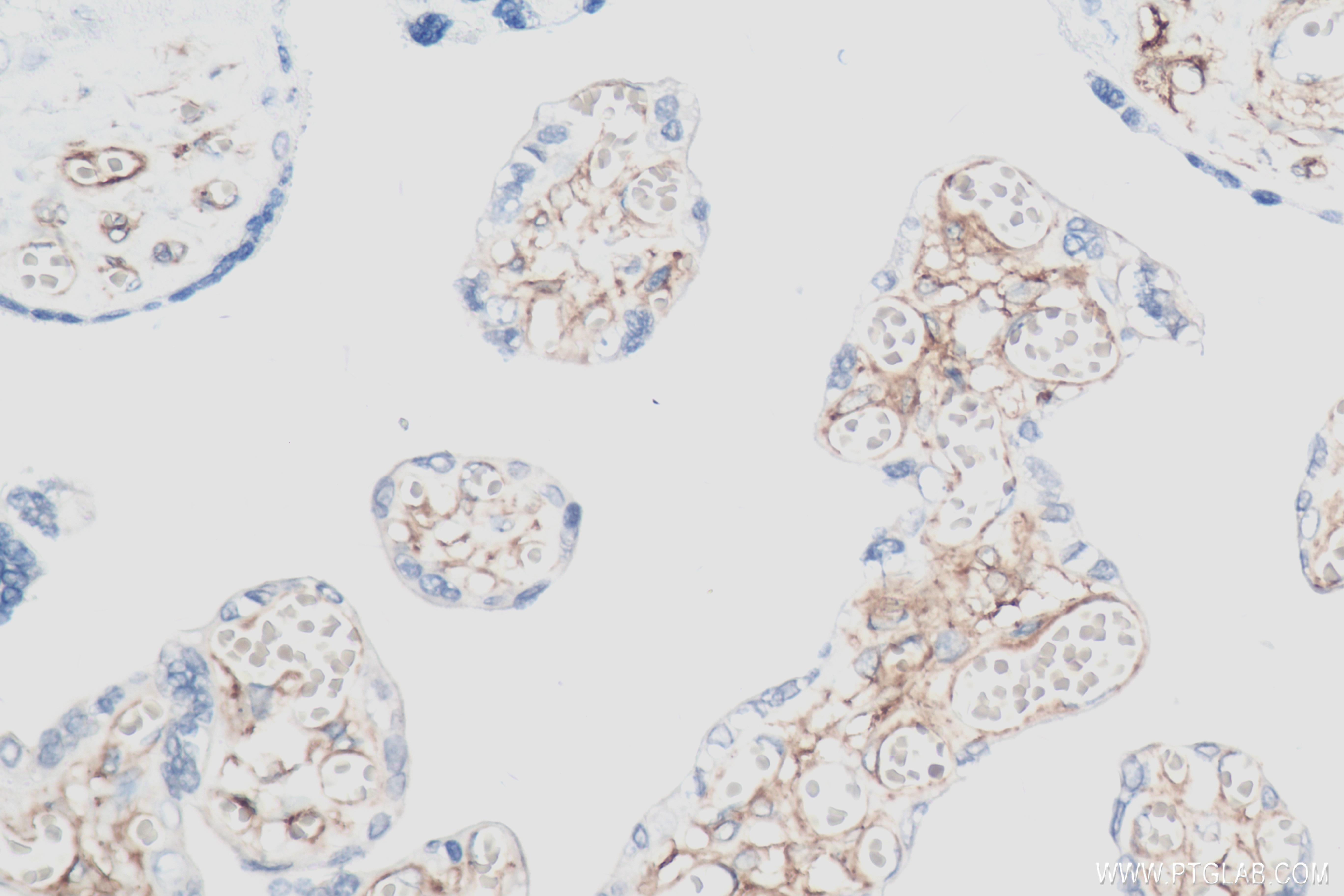 IHC staining of human placenta using 82943-1-RR