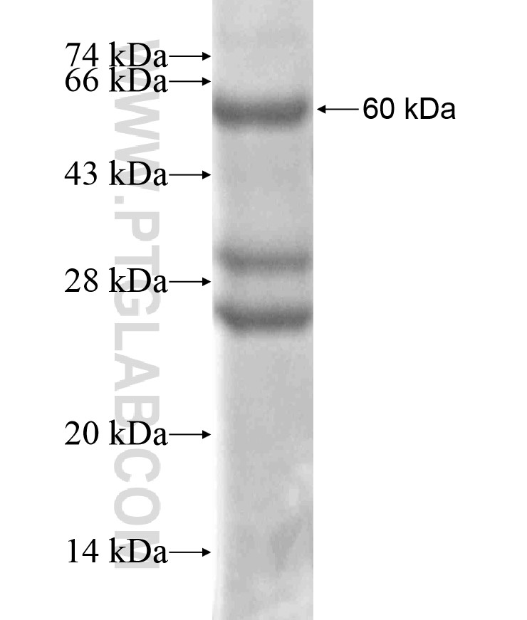 PDGFRB fusion protein Ag17561 SDS-PAGE PDGFRB fusion protein Ag17561 SDS-PAGE