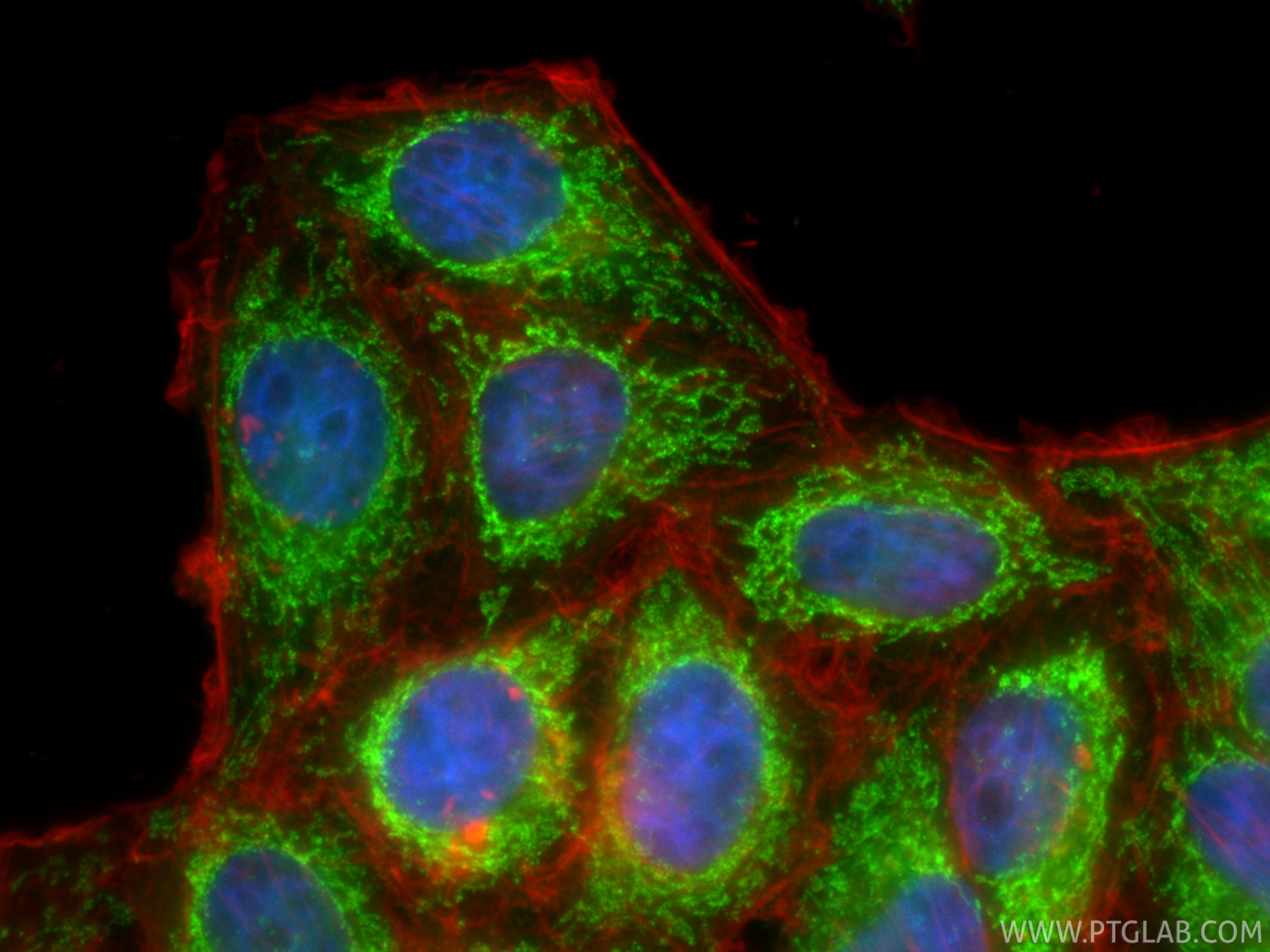 IF Staining of HepG2 using CL488-18068 IF Staining of HepG2 using CL488-18068