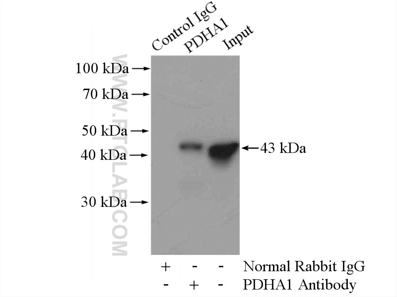 IP experiment of mouse kidney using 18068-1-AP