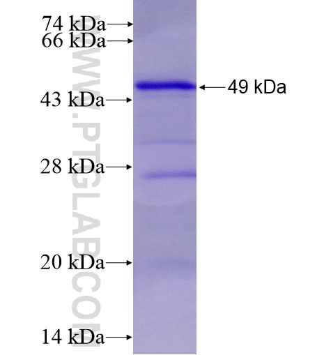 PDHA2 fusion protein Ag10617 SDS-PAGE PDHA2 fusion protein Ag10617 SDS-PAGE