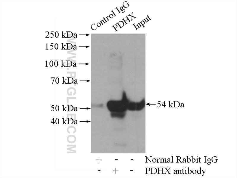 IP experiment of HEK-293 using 10951-1-AP