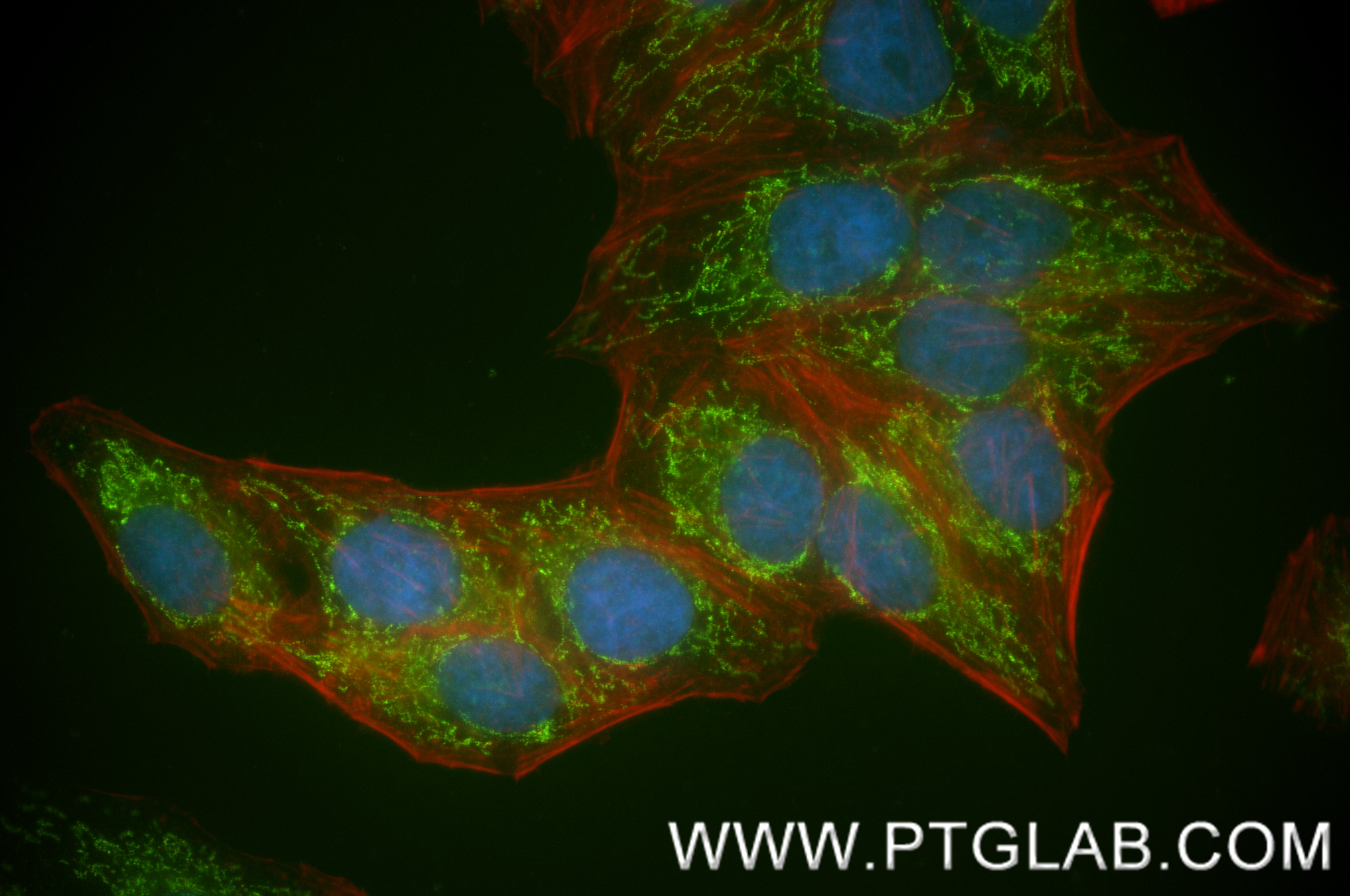 IF Staining of HepG2 using 87880-1-RR IF Staining of HepG2 using 87880-1-RR