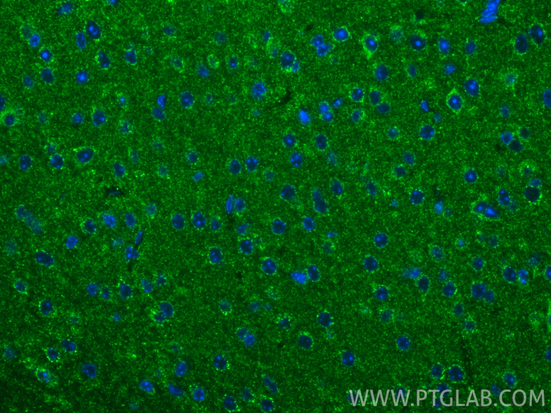 IF Staining of mouse brain using 87880-1-RR IF Staining of mouse brain using 87880-1-RR