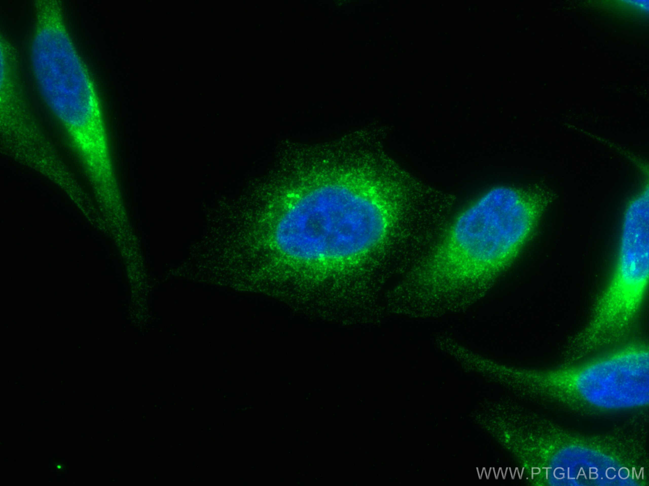 IF Staining of HepG2 using 66422-1-Ig (same clone as 66422-1-PBS)