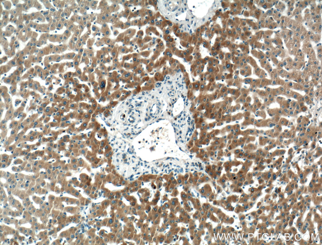 IHC staining of human liver using 66422-1-Ig (same clone as 66422-1-PBS)