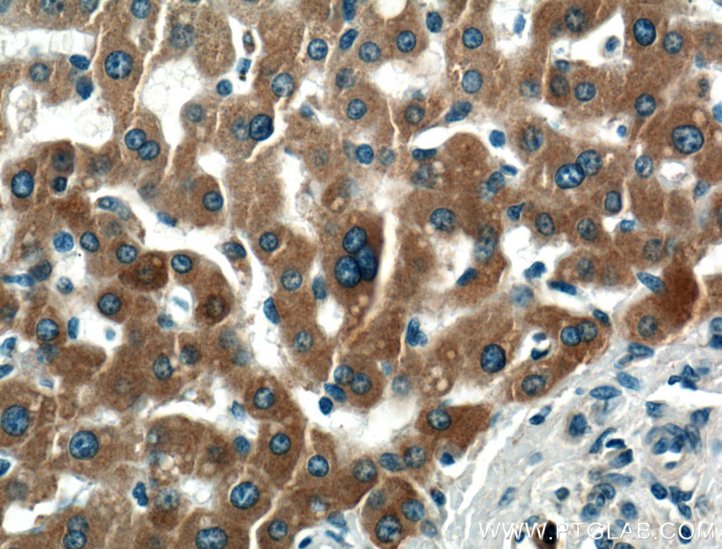 IHC staining of human liver using 66422-1-Ig (same clone as 66422-1-PBS)