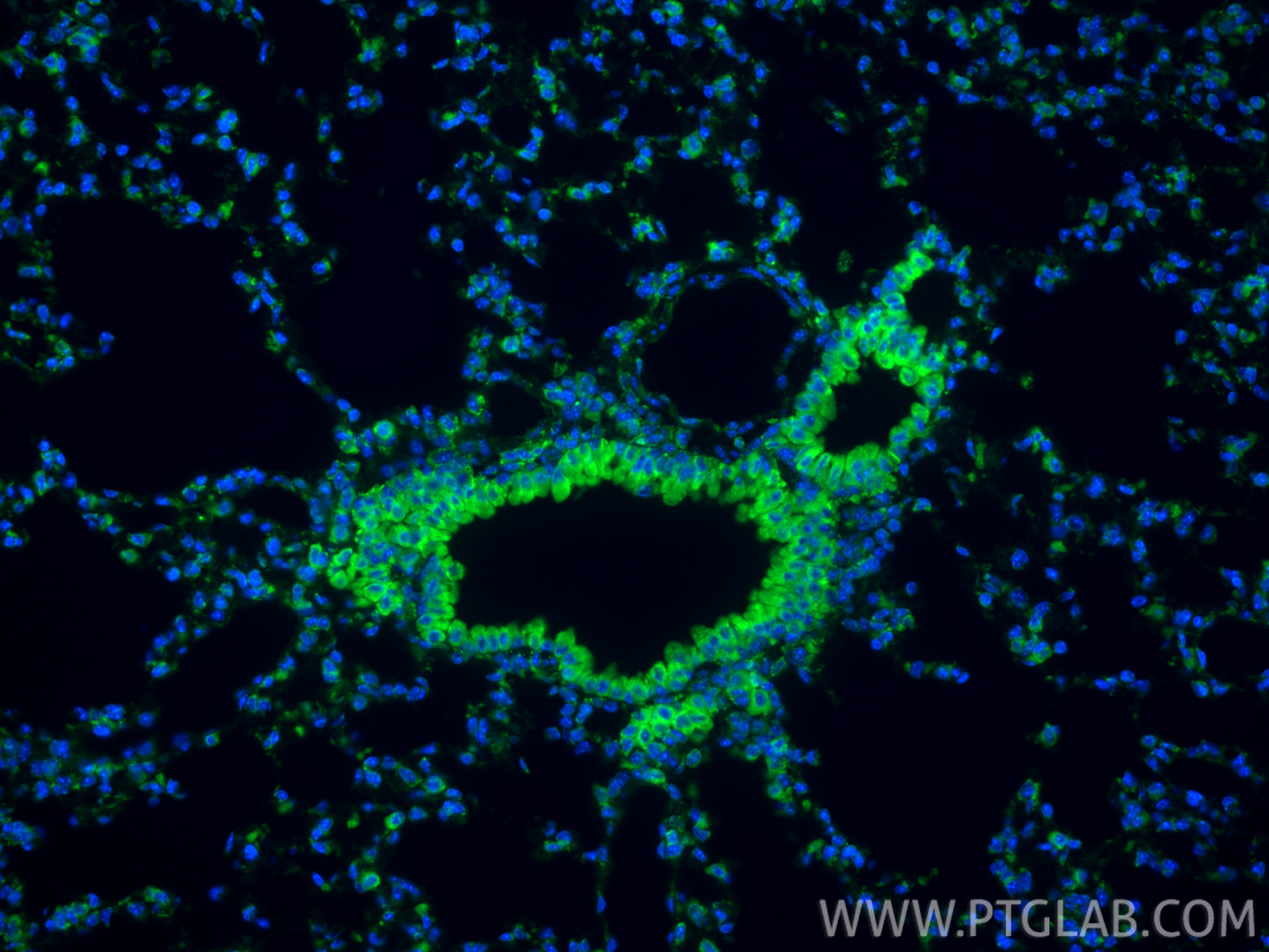 IF Staining of mouse lung using CL488-80170