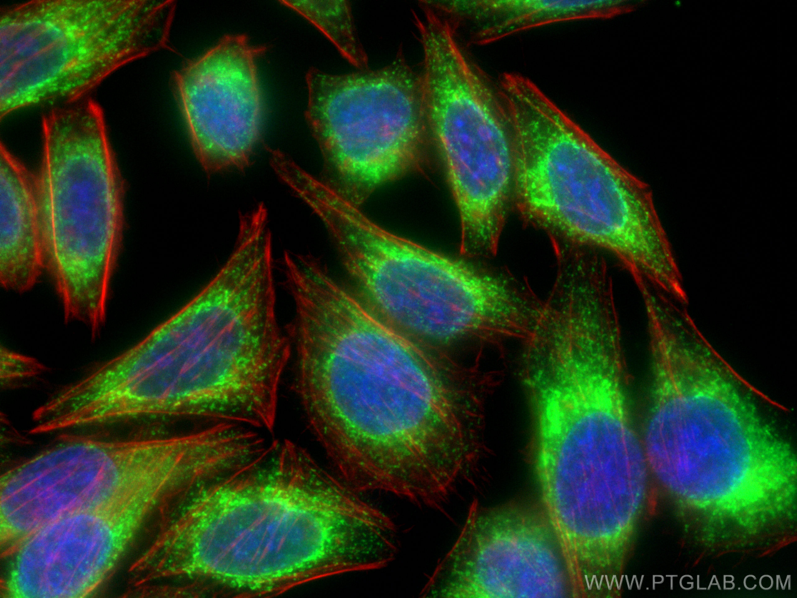 IF Staining of HepG2 using 11245-1-AP