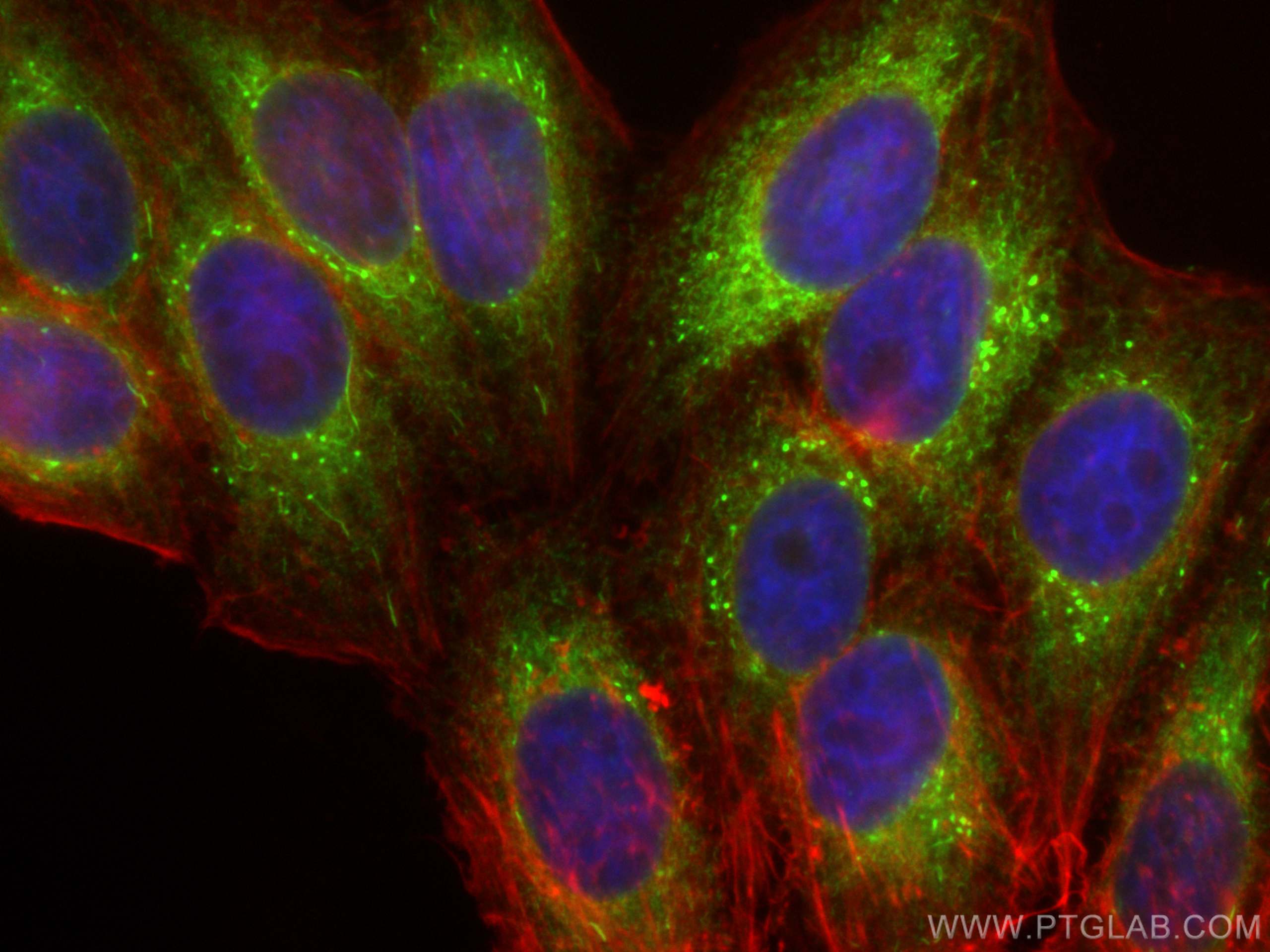IF Staining of HepG2 using 11245-1-AP