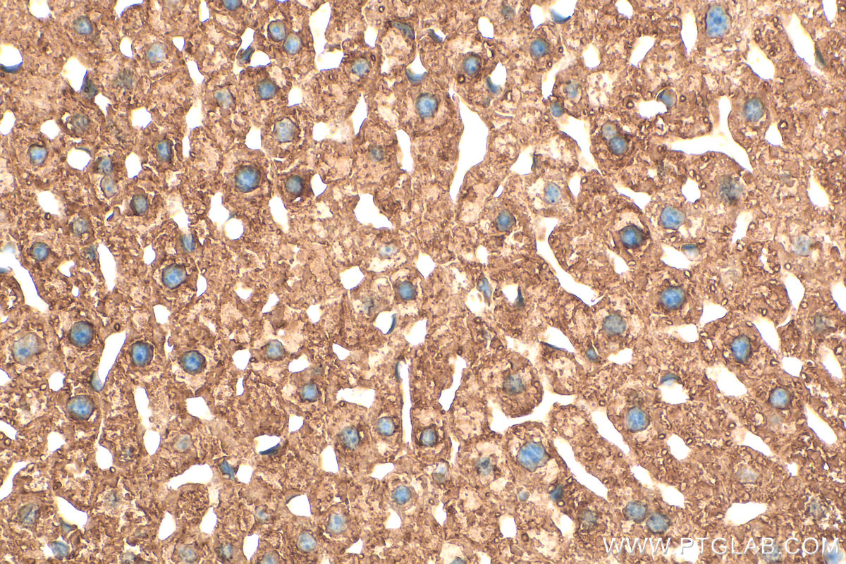 Immunohistochemical analysis of paraffin-embedded mouse liver tissue slide using 11245-1-AP (PDI antibody) at dilution of 1:200 (under 40x lens). Heat mediated antigen retrieval with Tris-EDTA buffer (pH 9.0). IHC staining of mouse liver using 11245-1-AP