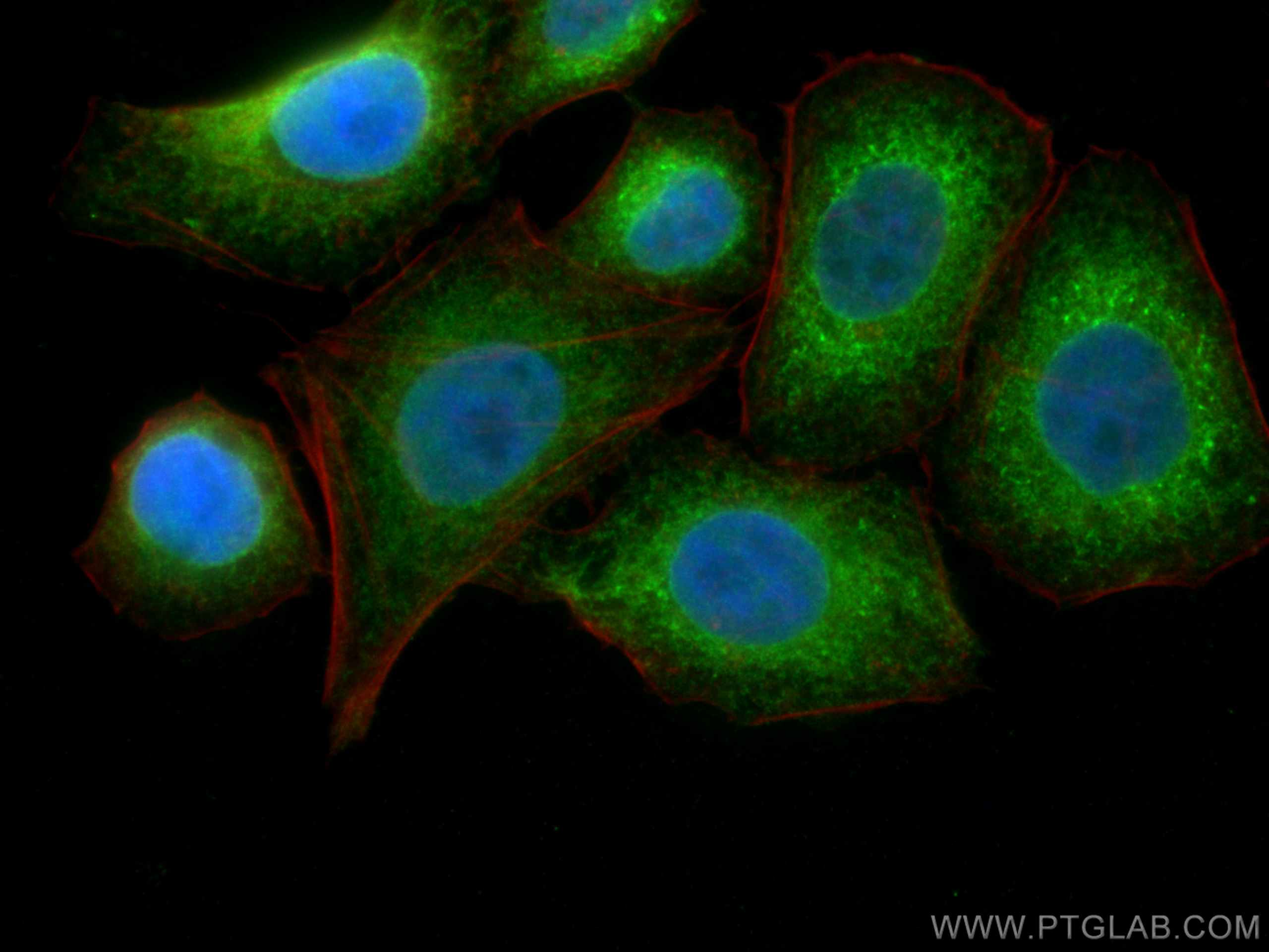 IF Staining of HepG2 using 15967-1-AP