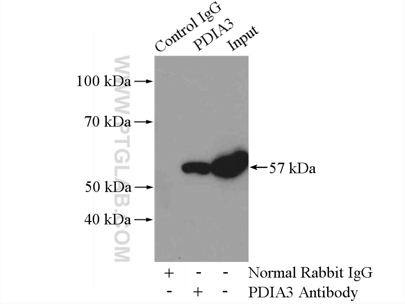 IP experiment of mouse liver using 15967-1-AP