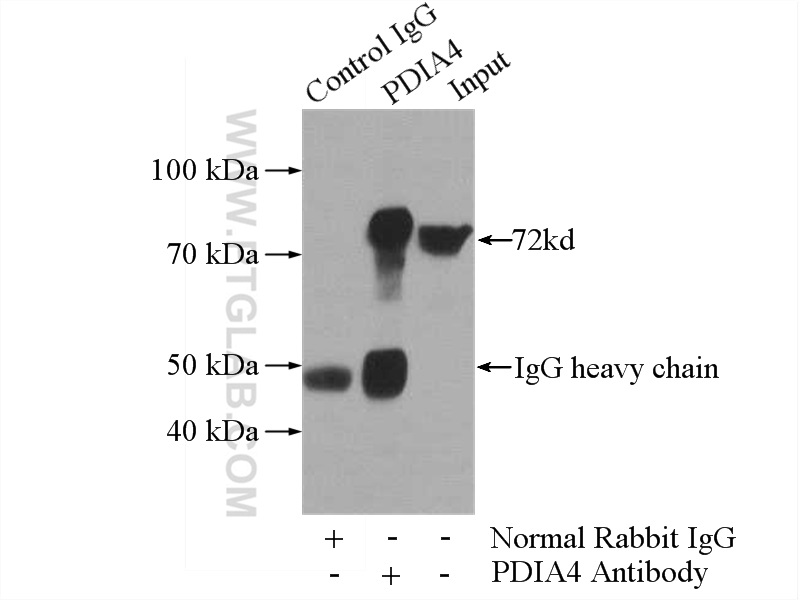 IP experiment of HeLa using 14712-1-AP