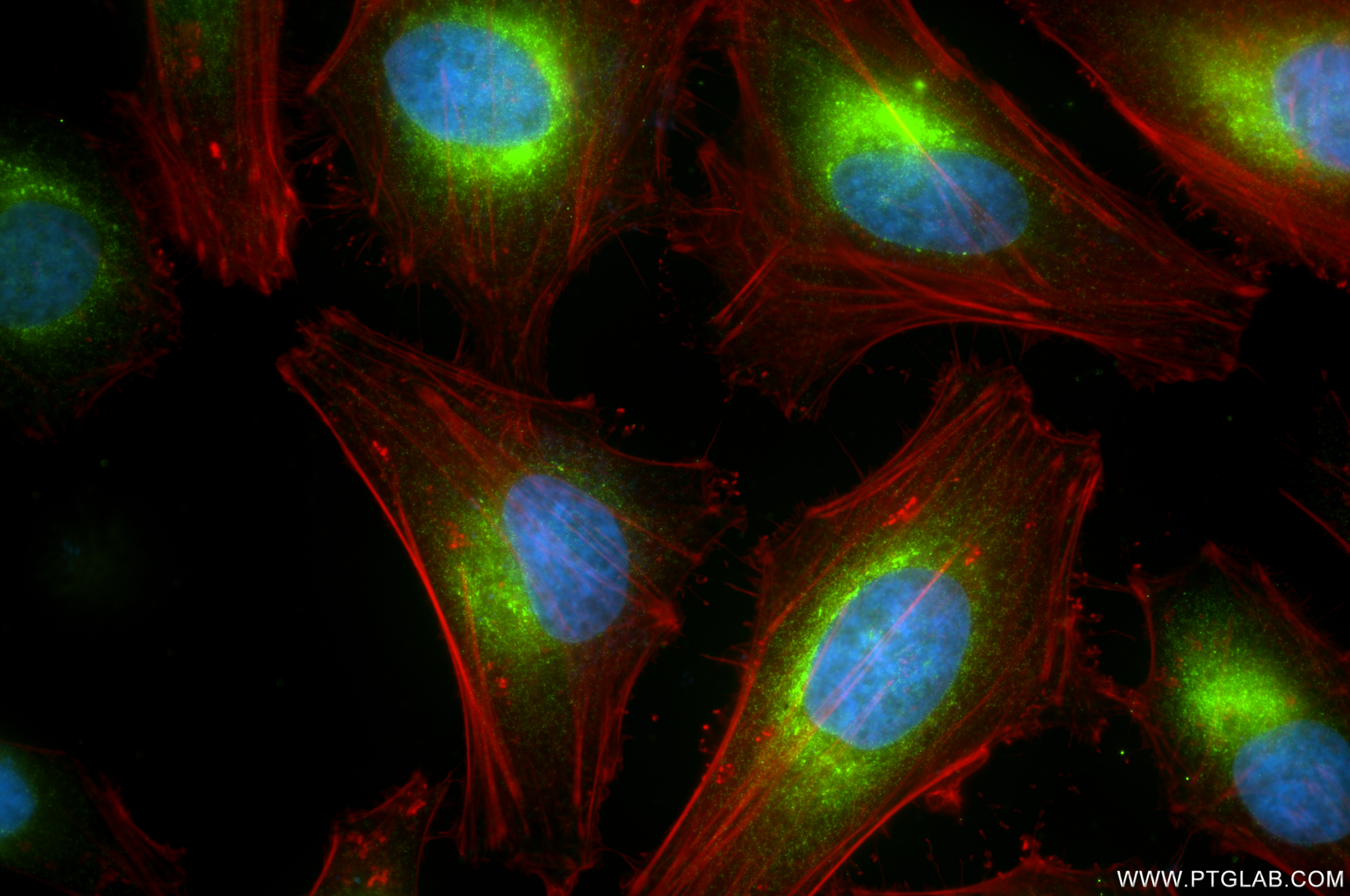 IF Staining of HeLa using 86239-1-RR