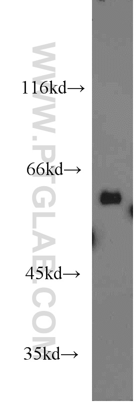 WB analysis of mouse liver using 15545-1-AP