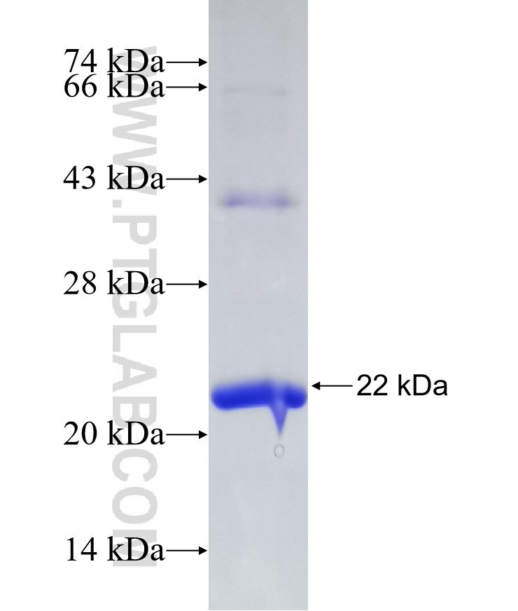 PDIA5 fusion protein Ag31493 SDS-PAGE PDIA5 fusion protein Ag31493 SDS-PAGE