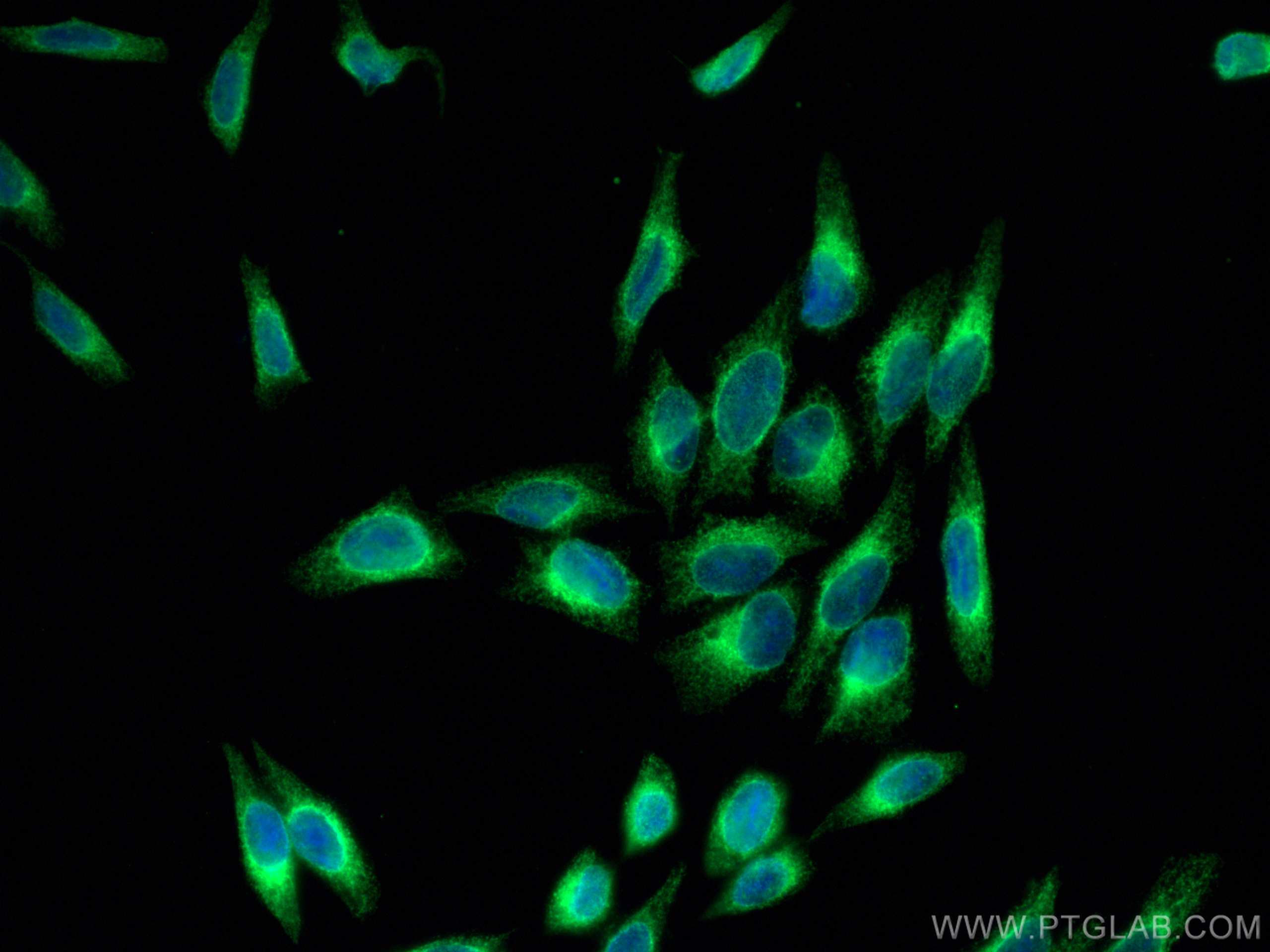 IF Staining of HepG2 using 66669-1-Ig (same clone as 66669-1-PBS)