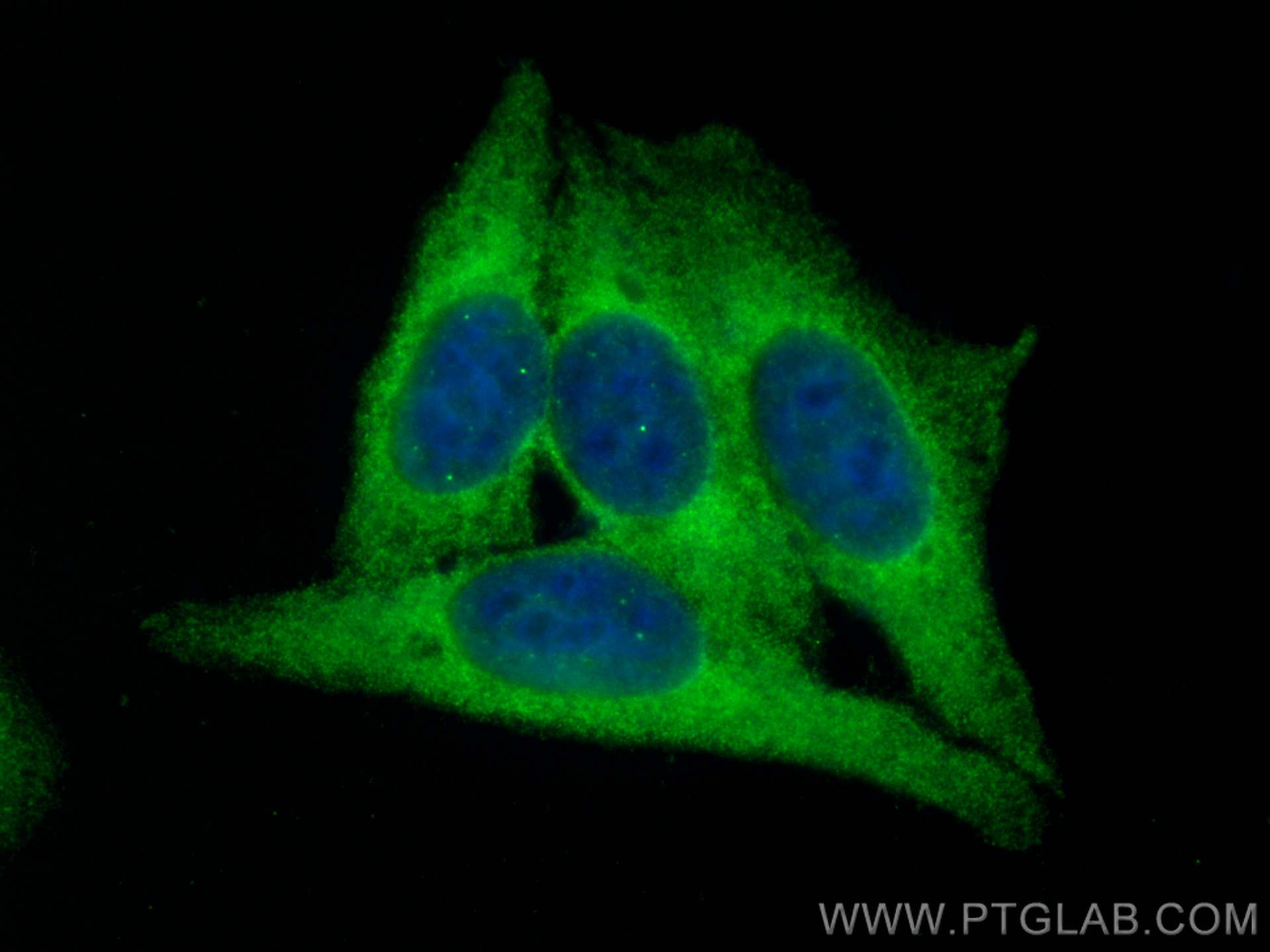 IF Staining of HepG2 using 66669-1-Ig