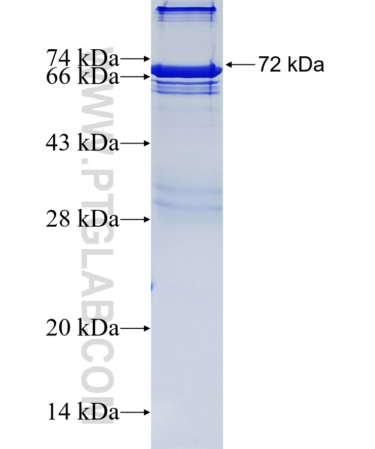 PDIA6 fusion protein Ag12940 SDS-PAGE