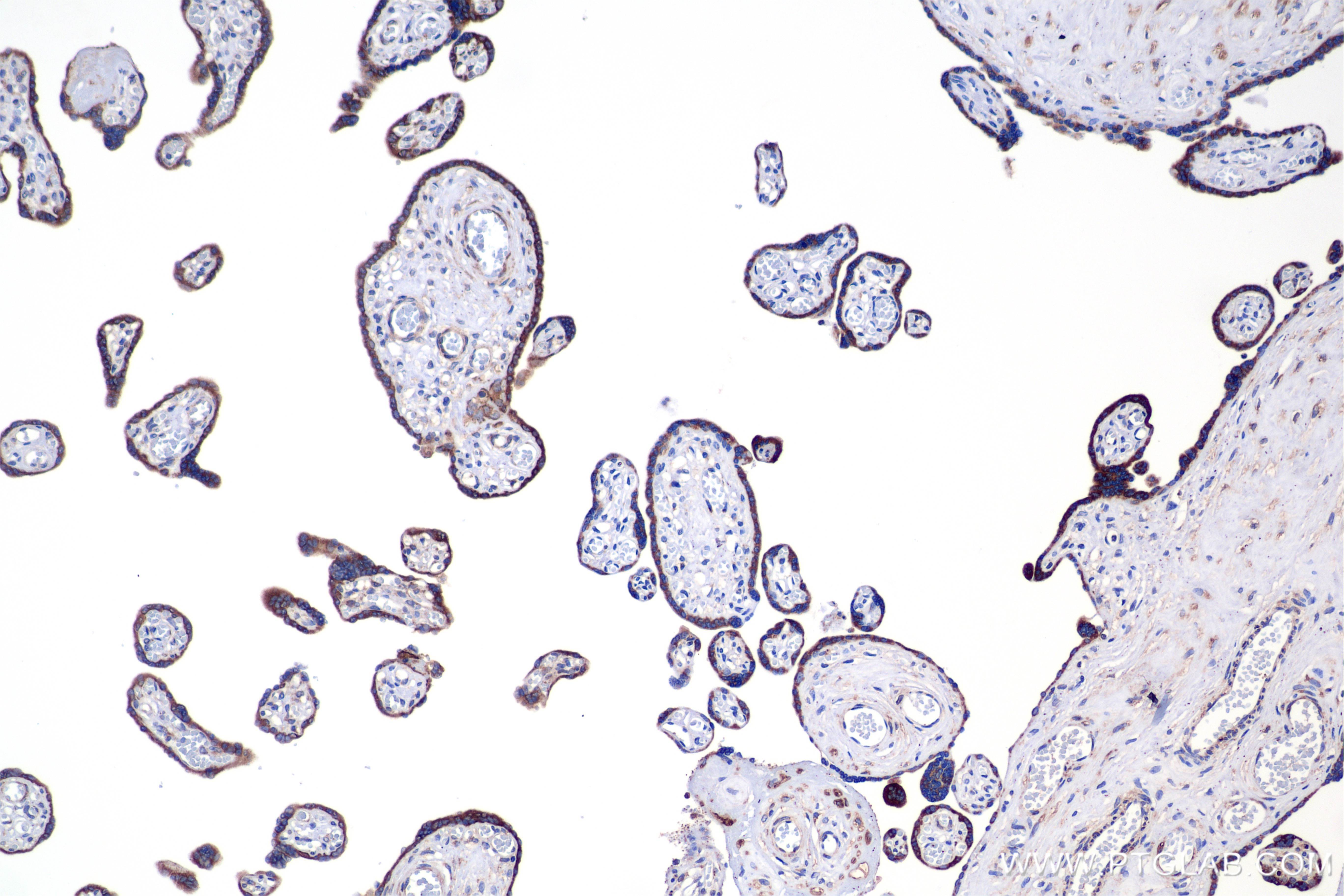 IHC staining of human placenta using 85599-4-RR
