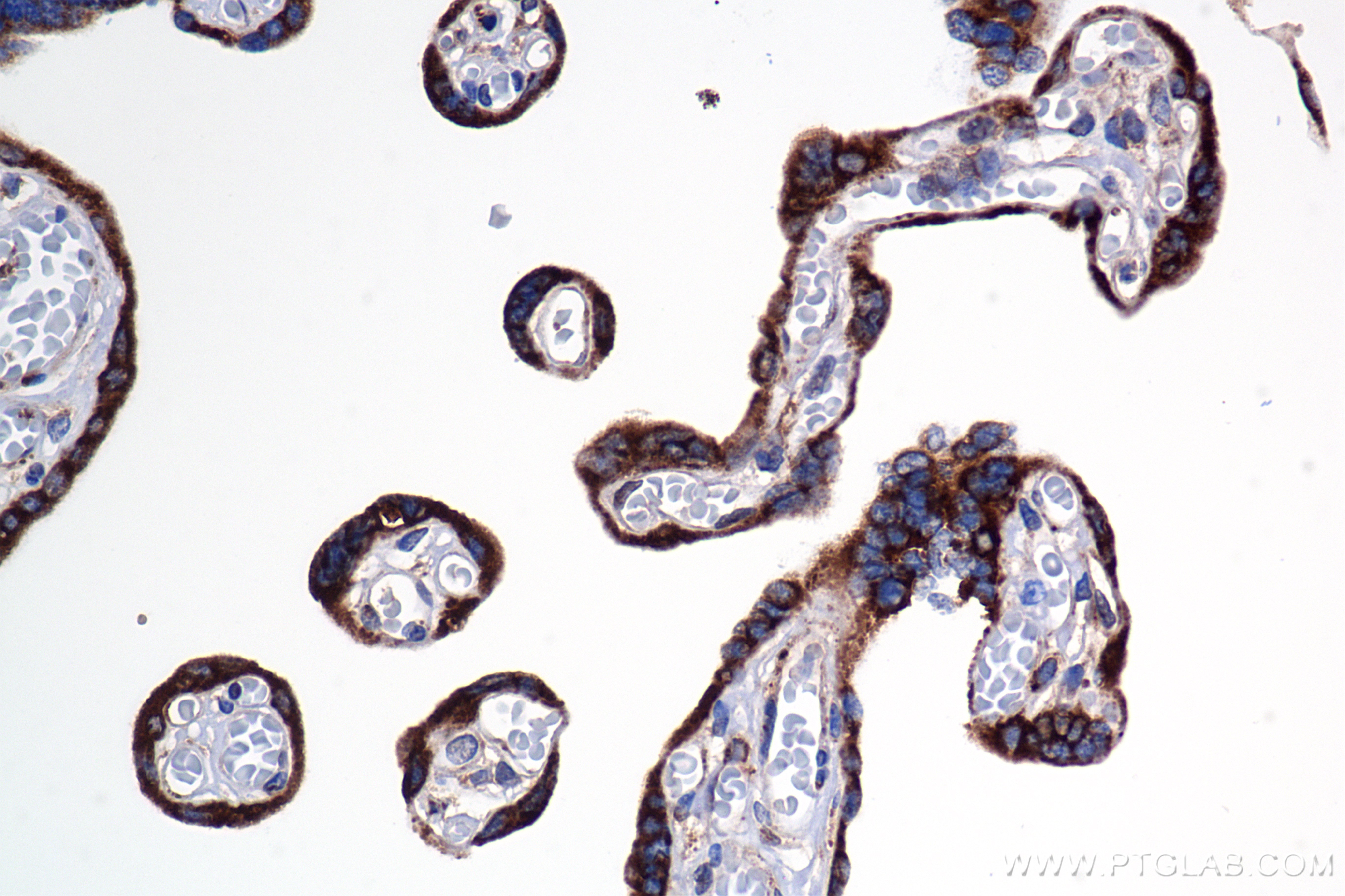 IHC staining of human placenta using 85599-4-RR
