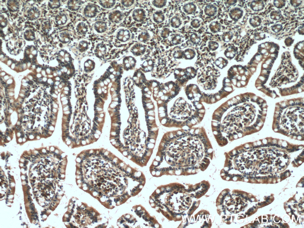 IHC staining of human small intestine using 10026-1-AP